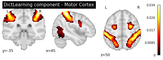 ../_images/functional_connectivity_98_2.png