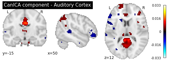 ../_images/functional_connectivity_99_1.png