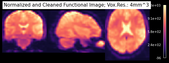 ../_images/machine_learning_preparation_3_1.png