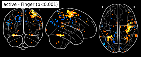 ../_images/statistical_analyses_MRI_45_0.png