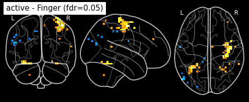 ../_images/statistical_analyses_MRI_51_0.png