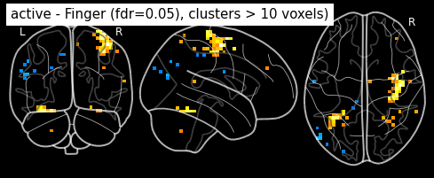 ../_images/statistical_analyses_MRI_54_0.png