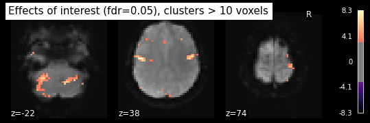 ../_images/statistical_analyses_MRI_81_0.png